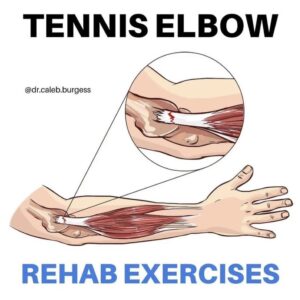 テニス肘 痛みのセルフケア方法４選