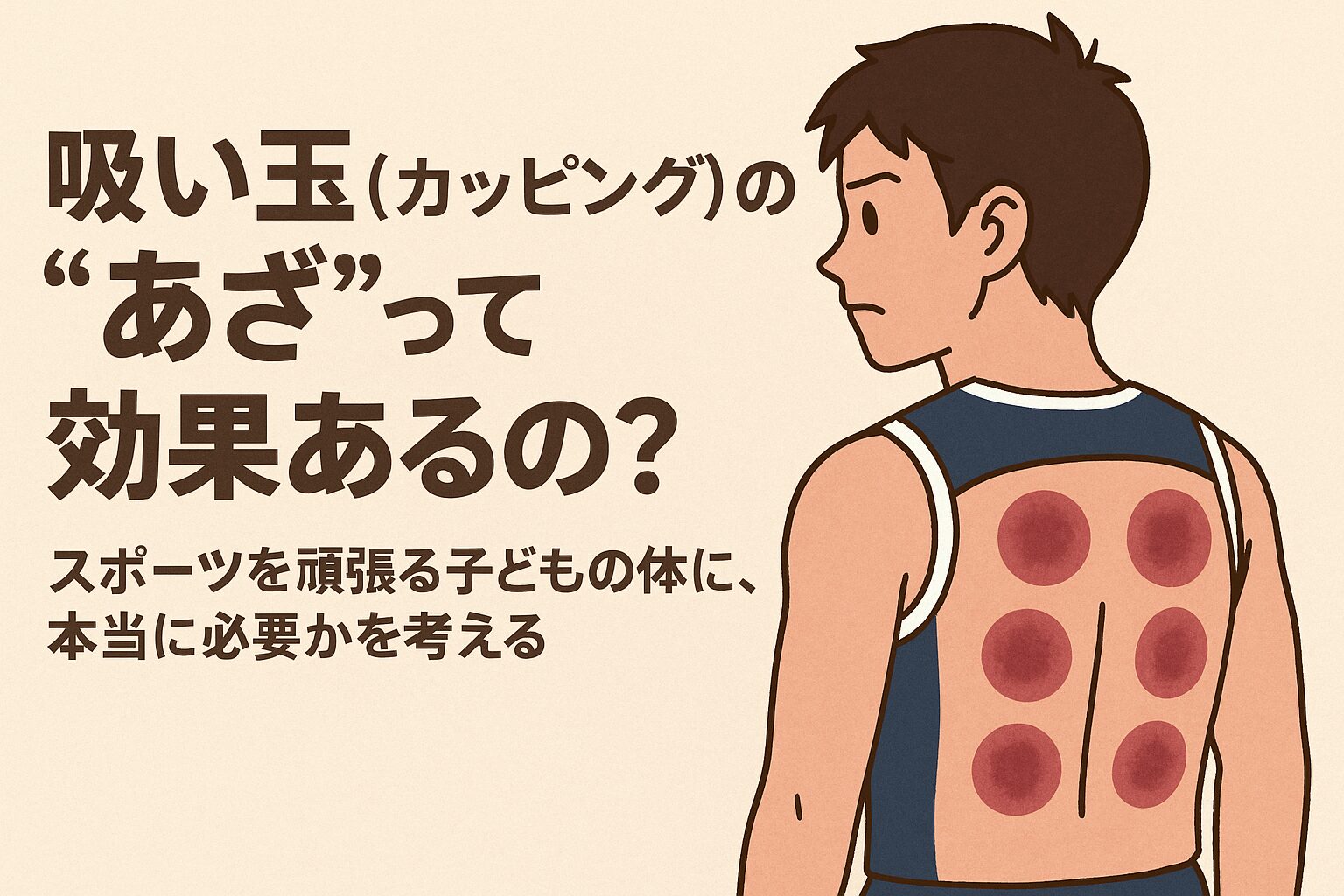 吸い玉（カッピング）の“あざ”って効果あるの？～スポーツを頑張る子どもの体に、本当に必要かを考える～